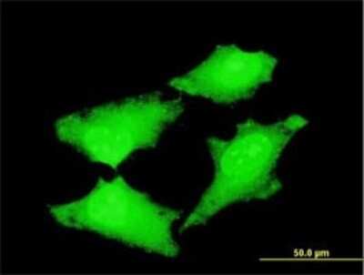 Immunocytochemistry/ Immunofluorescence: CDC45L Antibody (3F11-1F3) [H00008318-M01]