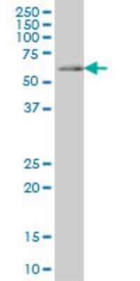 Western Blot: CDC45L Antibody (4C2) [H00008318-M02]
