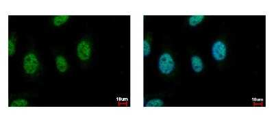 Immunocytochemistry/ Immunofluorescence: CDC45L Antibody [NBP1-32772]