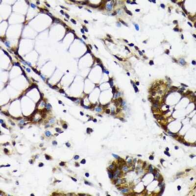 Immunohistochemistry-Paraffin: CDC5L Antibody (1D10W9) [NBP3-16816]