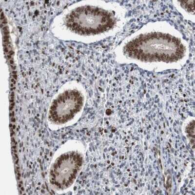 Immunohistochemistry-Paraffin: CDC5L Antibody [NBP1-85720]
