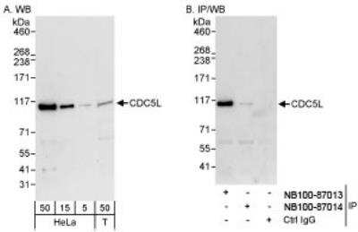 Western Blot: CDC5L Antibody [NB100-87014]