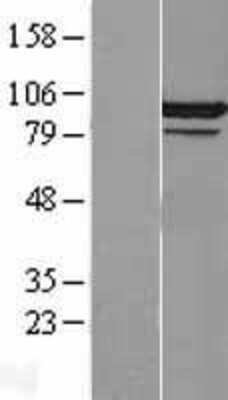 Western Blot: CDC5L Overexpression Lysate [NBL1-09013]