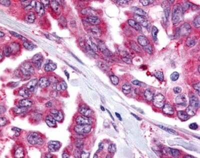 Immunohistochemistry-Paraffin: CDC7 Antibody - BSA Free [NLS7979]