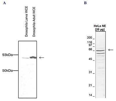 Western Blot: CDC73/HRPT2 Antibody [NBP2-59257]