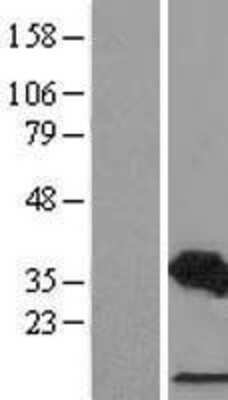 Western Blot: CDCA3 Overexpression Lysate [NBL1-09016]