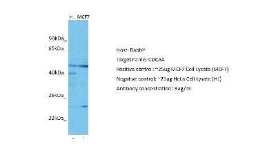 Western Blot: CDCA4 Antibody [NBP2-84642]