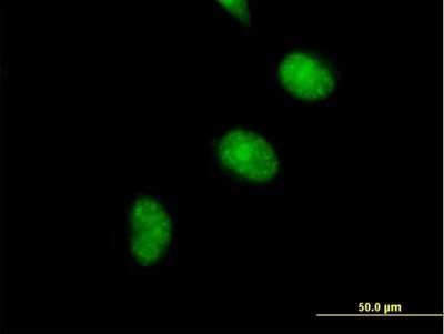 Immunocytochemistry/ Immunofluorescence: CDCA5 Antibody [H00113130-B01P]