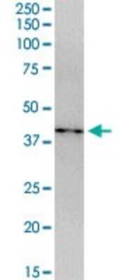 Western Blot: CDCA5 Antibody [H00113130-B01P]