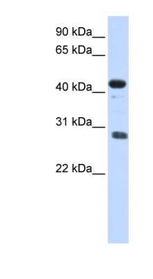 Western Blot: CDCA5 Antibody [NBP1-55144]