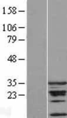 Western Blot: CDCA5 Overexpression Lysate [NBL1-09019]