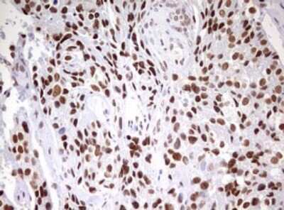 Immunohistochemistry: CDCA7L Antibody (OTI3B5) [NBP2-46198]