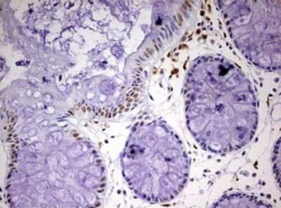 Immunohistochemistry: CDCA7L Antibody (OTI3B5) [NBP2-46198]