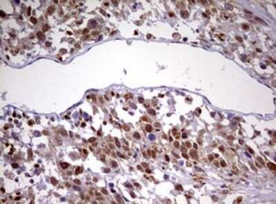 Immunohistochemistry: CDCA7L Antibody (OTI3B5) [NBP2-46198]