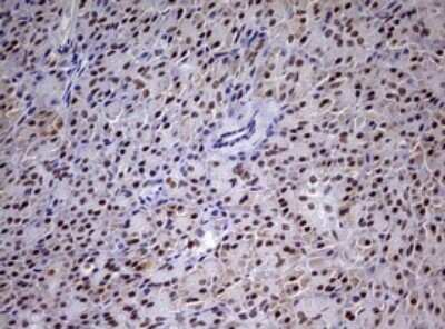 Immunohistochemistry: CDCA7L Antibody (OTI3B5) [NBP2-46198]