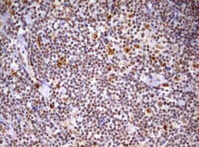 Immunohistochemistry: CDCA7L Antibody (OTI3B5) [NBP2-46198]
