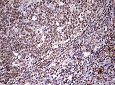 Immunohistochemistry: CDCA7L Antibody (OTI3B5) [NBP2-46198]