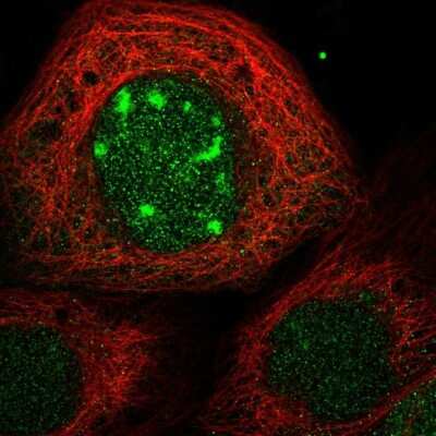 Immunocytochemistry/ Immunofluorescence: CDCA7L Antibody [NBP1-83074]