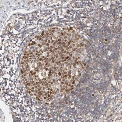 Immunohistochemistry-Paraffin: CDCA7L Antibody [NBP1-83074]