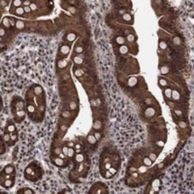 Immunohistochemistry-Paraffin: CDCA7L Antibody [NBP3-17194]