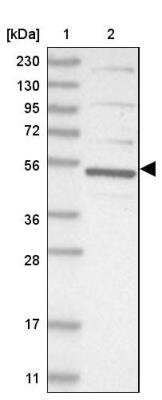 Western Blot: CDCA7L Antibody [NBP1-83074]