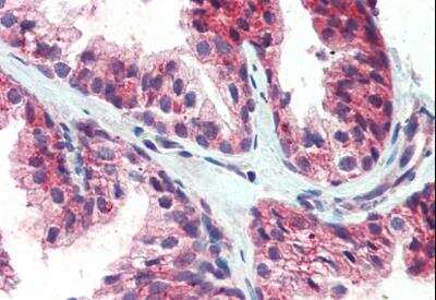 Immunohistochemistry-Paraffin: CDCP1 Antibody [NB100-860]
