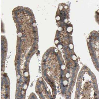 Immunohistochemistry-Paraffin: CDCP1 Antibody [NBP1-85758]