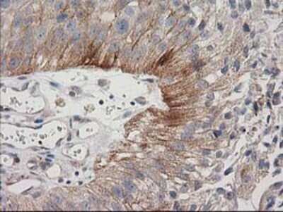 Immunohistochemistry: CDCP1 Antibody (OTI2C1) - Azide and BSA Free [NBP2-72156]