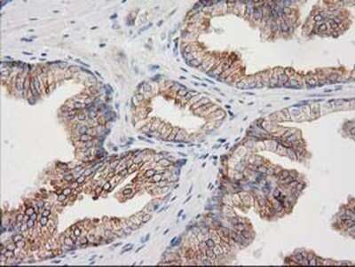 Immunohistochemistry: CDCP1 Antibody (OTI2C1) - Azide and BSA Free [NBP2-72156]