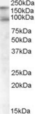 Western Blot: CDCP1 Antibody [NB100-860]