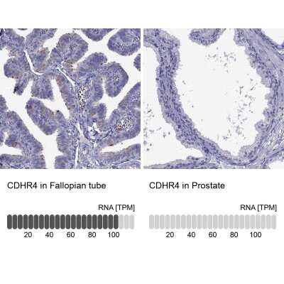 Immunohistochemistry-Paraffin: CDHR4 Antibody [NBP2-62703]