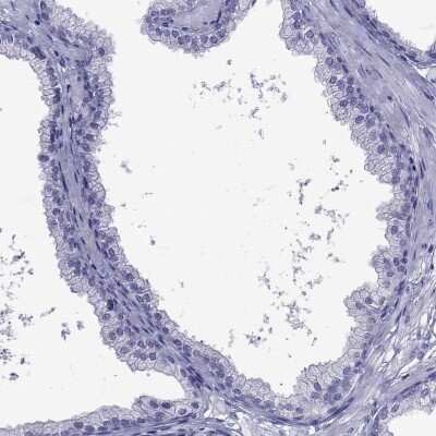 Immunohistochemistry-Paraffin: CDHR4 Antibody [NBP2-62703]