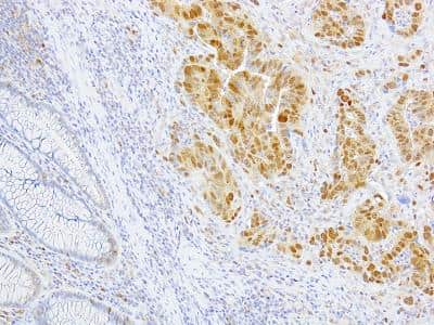 Immunohistochemistry-Paraffin: CDK2 Antibody (1A6) - BSA Free [NBP2-37507]
