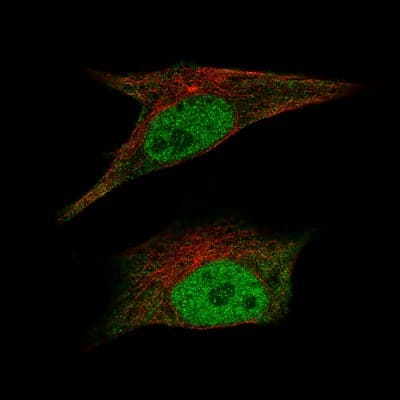Immunocytochemistry/ Immunofluorescence: CDK2 Antibody (CL7990) [NBP2-88911]