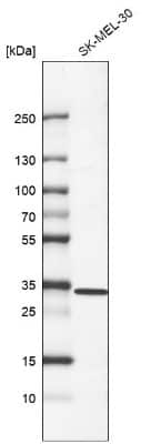 Western Blot: CDK2 Antibody (CL7990) [NBP2-88911]