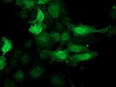 Immunocytochemistry/ Immunofluorescence: CDK2 Antibody (OTI2D9) - Azide and BSA Free [NBP2-70392]