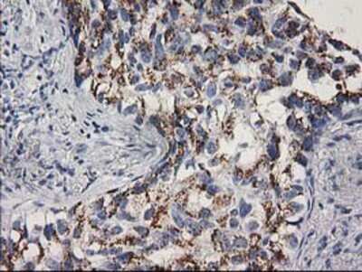 Immunohistochemistry: CDK2 Antibody (OTI2D9) - Azide and BSA Free [NBP2-70392]