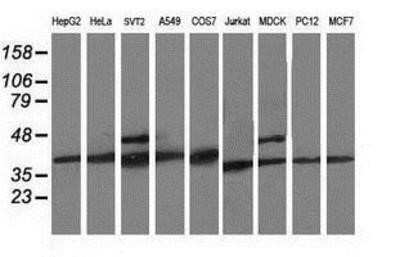 Western Blot: CDK2 Antibody (OTI2D9)Azide and BSA Free [NBP2-70392]