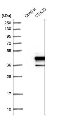 Western Blot: CDK20 Antibody [NBP1-91215]