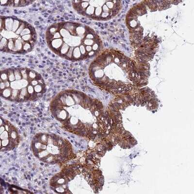 Immunohistochemistry-Paraffin: CDK2AP2 Antibody [NBP1-91776]