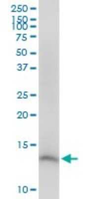 Western Blot: CDK2AP2 Antibody [H00010263-B01P]
