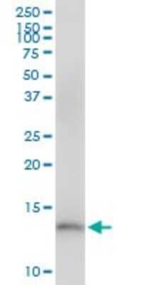 Western Blot: CDK2AP2 Antibody [H00010263-B01P]