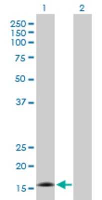 Western Blot: CDK2AP2 Antibody [H00010263-B01P]