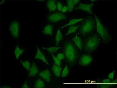 Immunocytochemistry/ Immunofluorescence: CDK4 Antibody (2G7) [H00001019-M04]