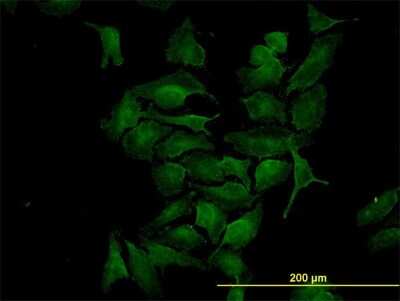 Immunocytochemistry/ Immunofluorescence: CDK4 Antibody (4F11) [H00001019-M03]