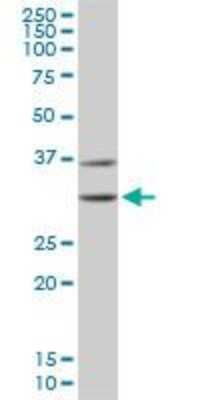Western Blot: CDK4 Antibody (4F11) [H00001019-M03]