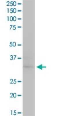 Western Blot: CDK4 Antibody (4F11) [H00001019-M03]