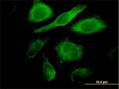 Immunocytochemistry/ Immunofluorescence: CDK4 Antibody (8A10) [H00001019-M09]