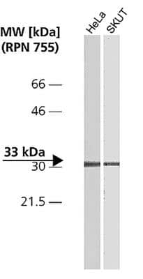 Western Blot: CDK4 Antibody (DCS-31) [NB120-6315]
