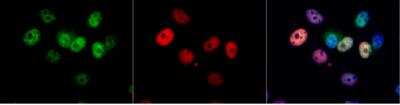 Immunocytochemistry/ Immunofluorescence: CDK4 Antibody [NBP1-31308]